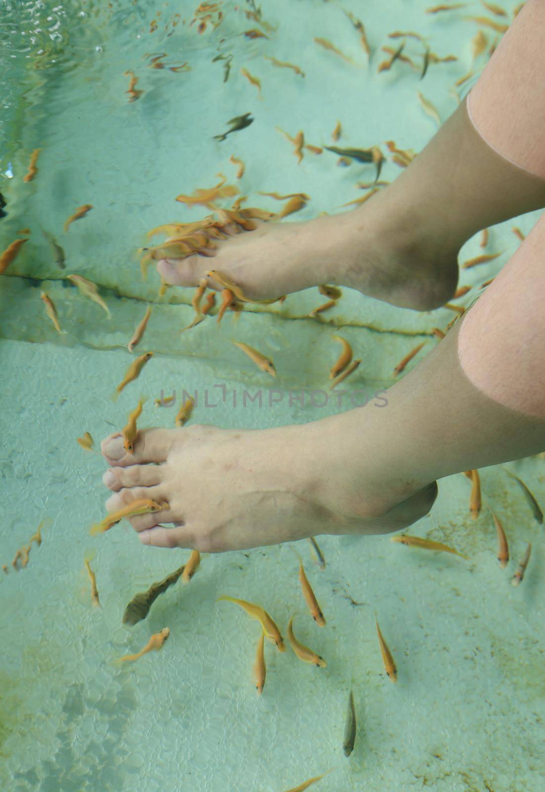 Fish Spa for foot Skin Therapy