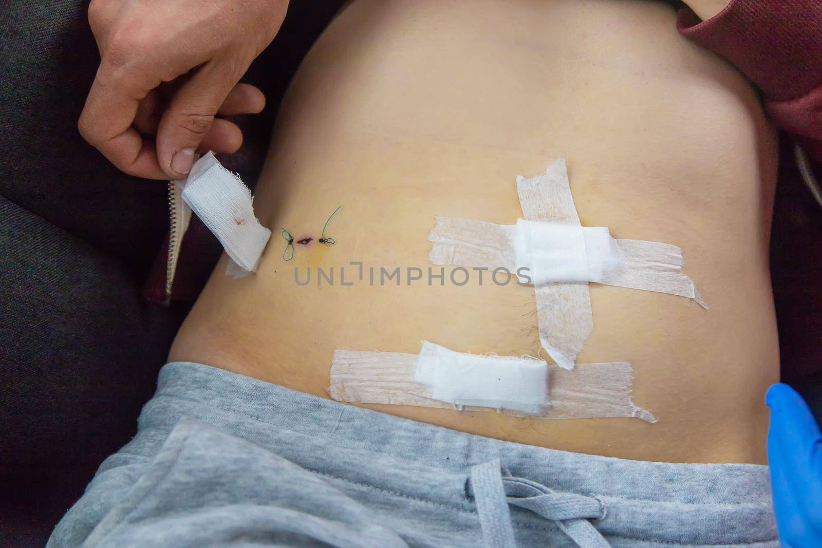 Examination of the patient by a doctor after removal of the appendix