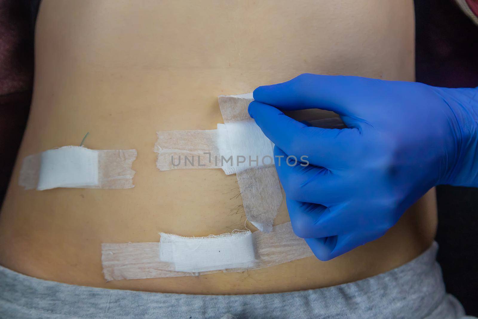 Examination of the patient by a doctor after removal of the appendix