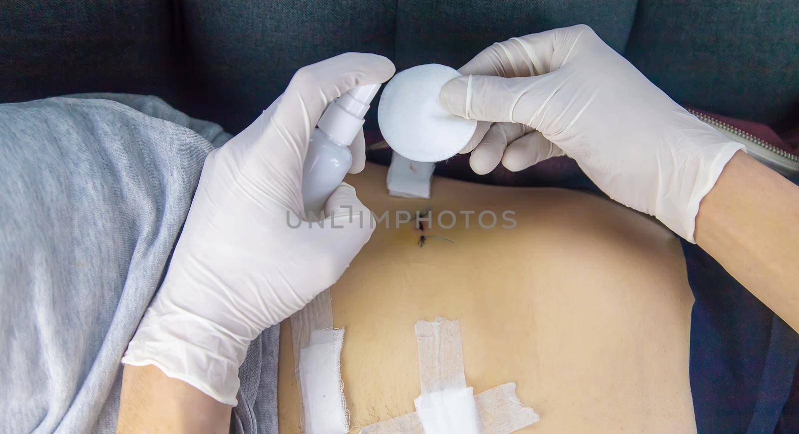 Examination of the patient by a doctor after removal of the appendix
