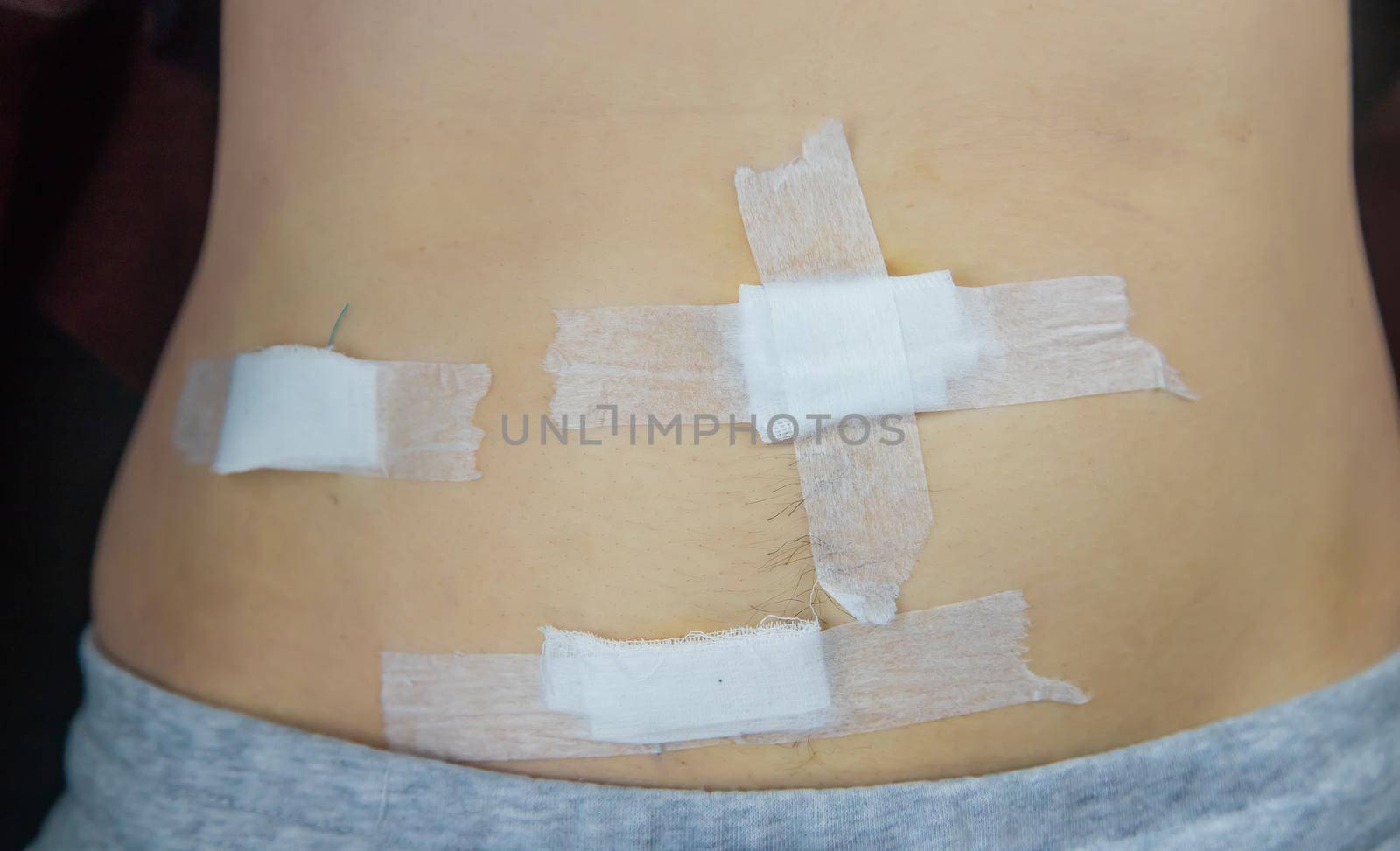 Examination of the patient by a doctor after removal of the appendix