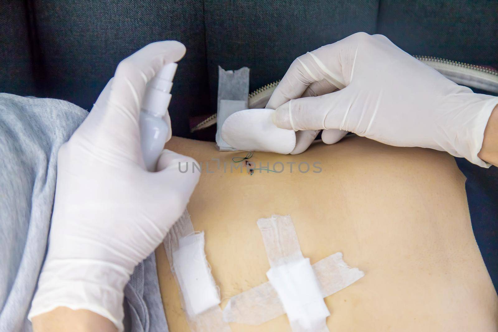 Examination of the patient by a doctor after removal of the appendix