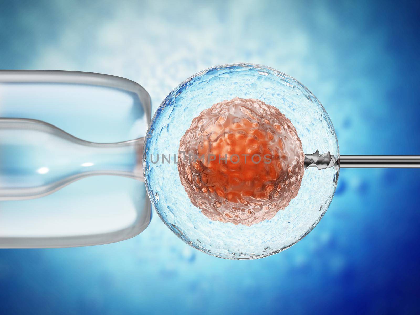 3D illustration of artificial insemination process showings sperms being injected inside the ovule. 3D illustration by Simsek