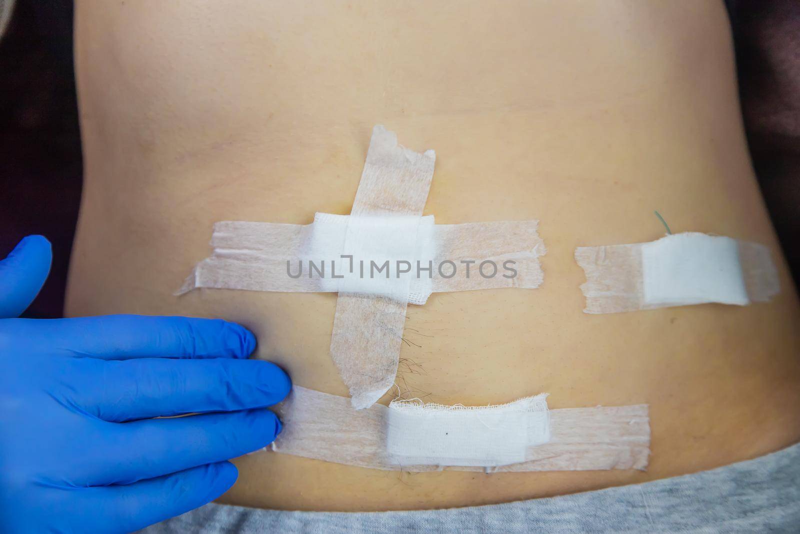 Examination of the patient by a doctor after removal of the appendix