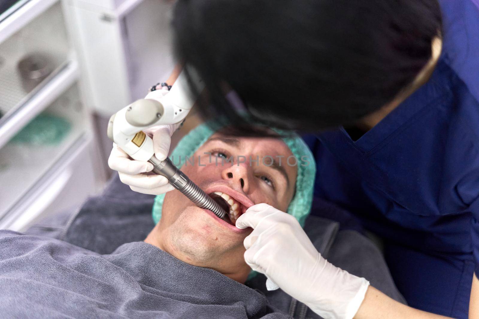 Top view of a patient with mouth open while undergoing intra-oral facial rejuvenation treatment