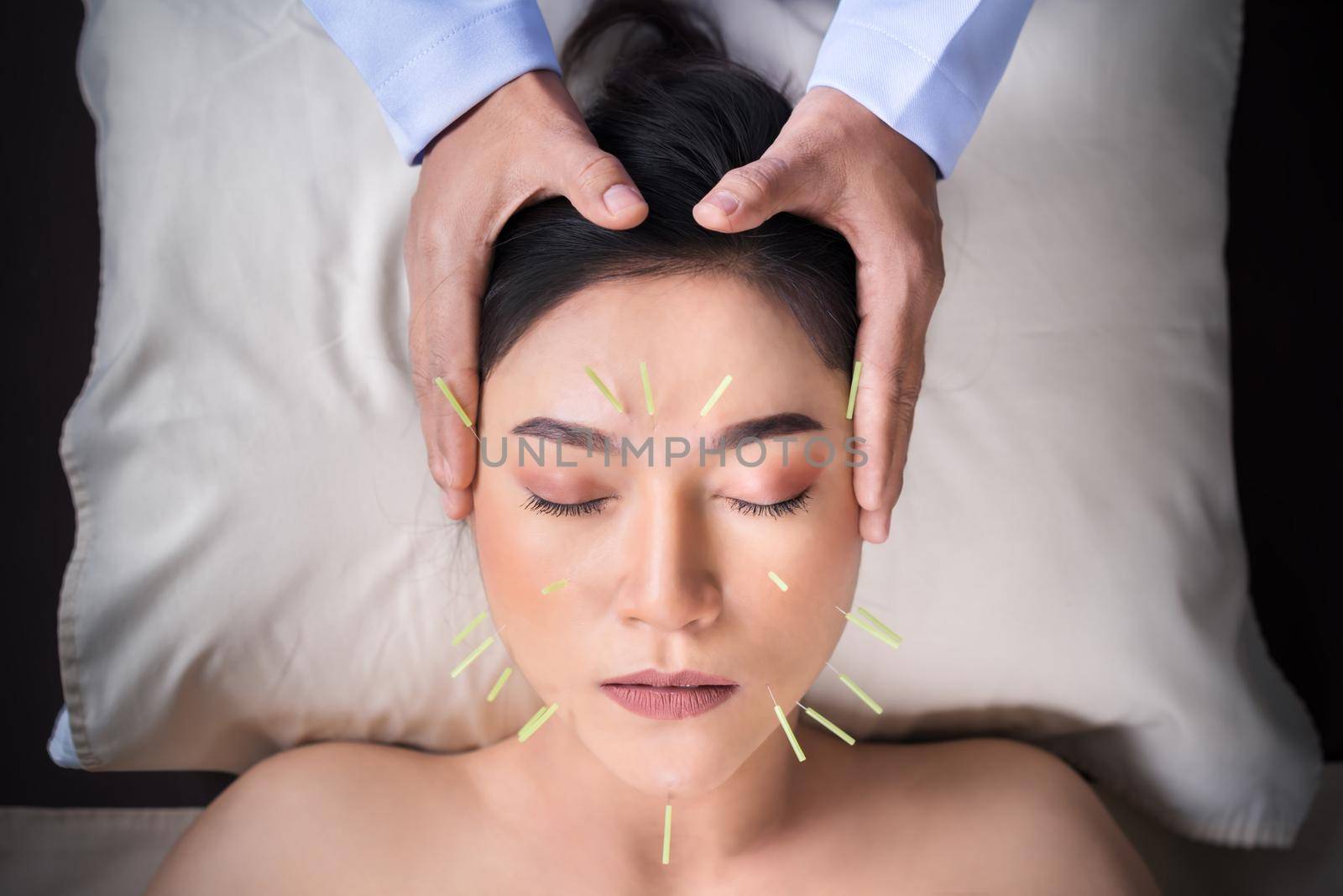 woman undergoing acupuncture treatment on face by geargodz