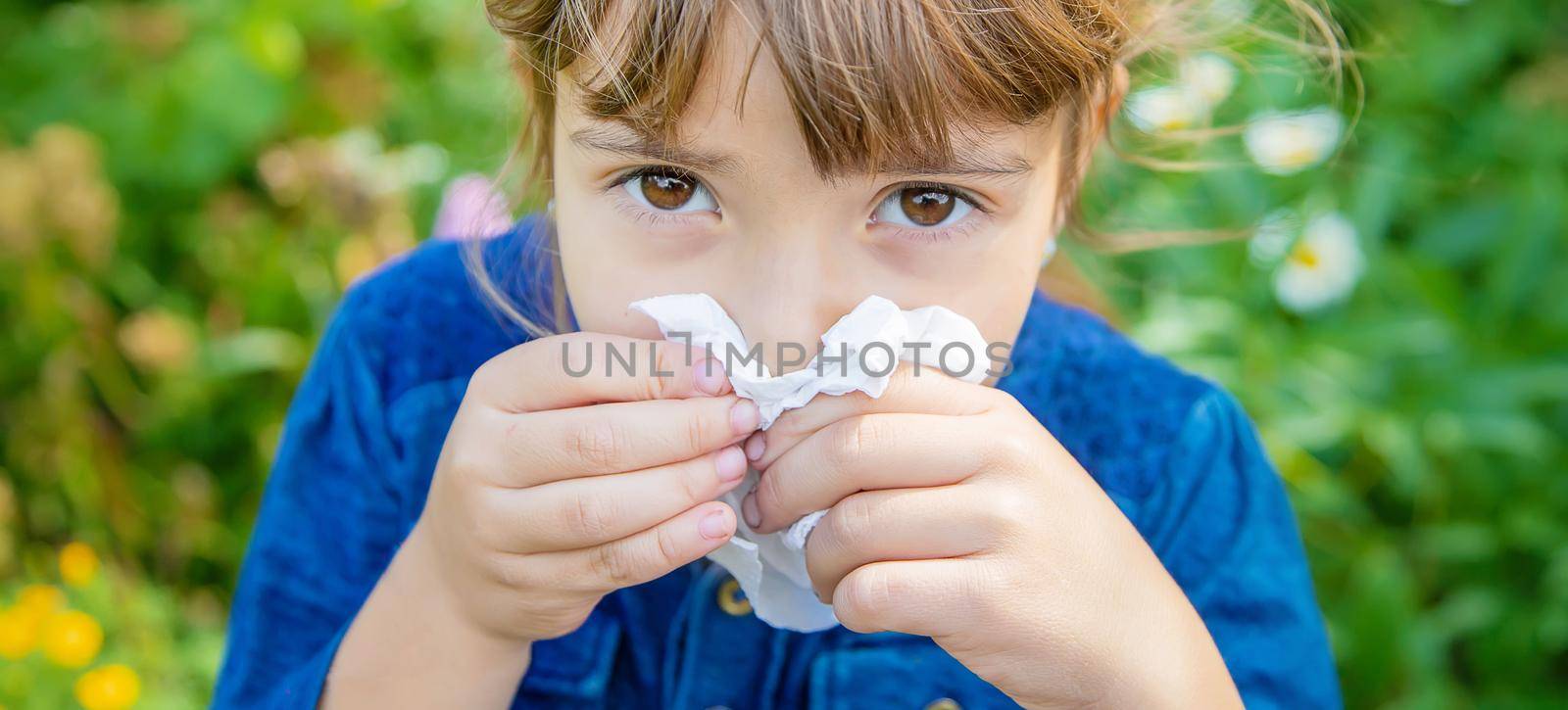 Seasonal allergy in a child. Coryza. Selective focus. by yanadjana