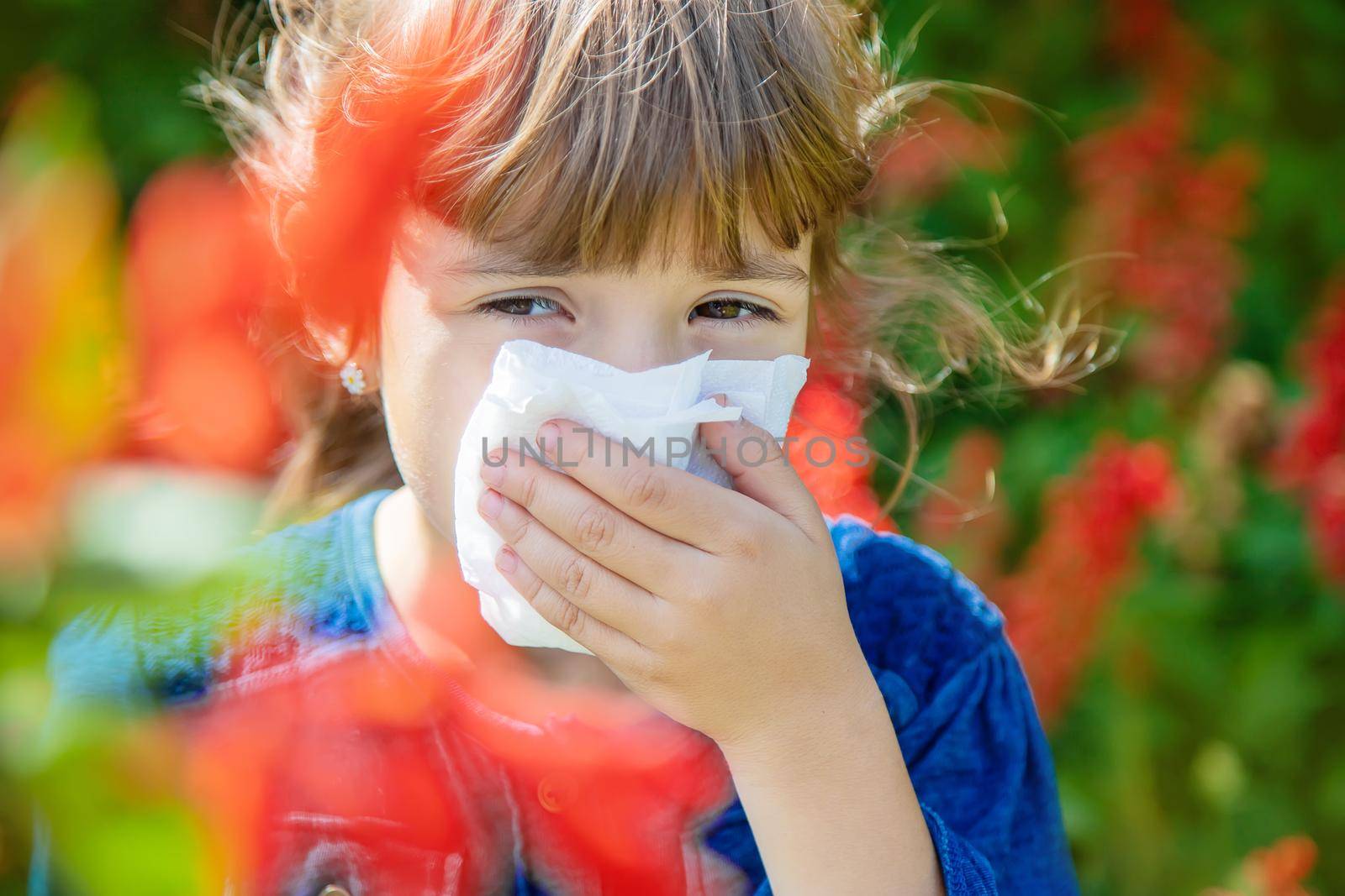 Seasonal allergy in a child. Coryza. Selective focus.