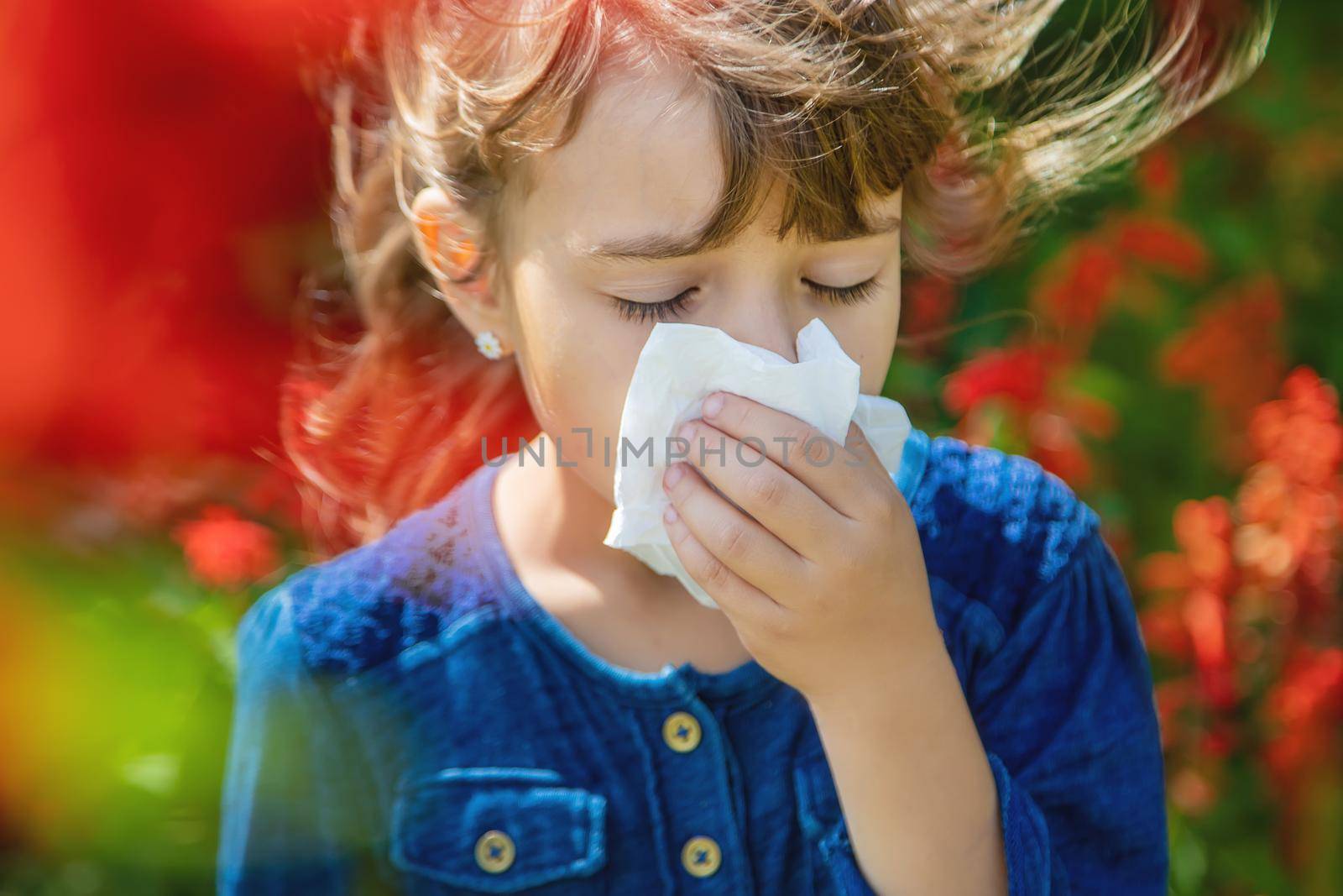 Seasonal allergy in a child. Coryza. Selective focus.