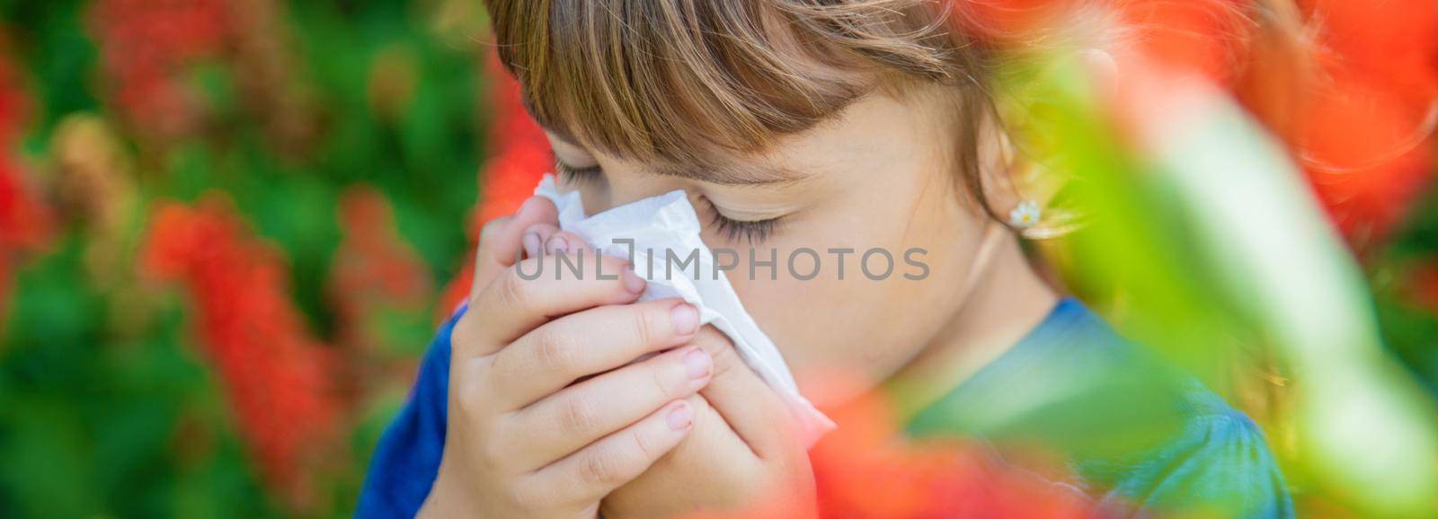 Seasonal allergy in a child. Coryza. Selective focus.