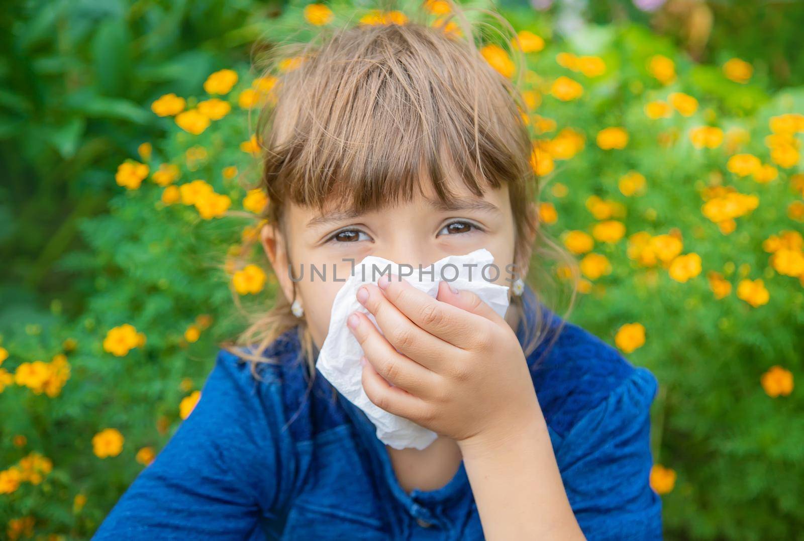 Seasonal allergy in a child. Coryza. Selective focus.