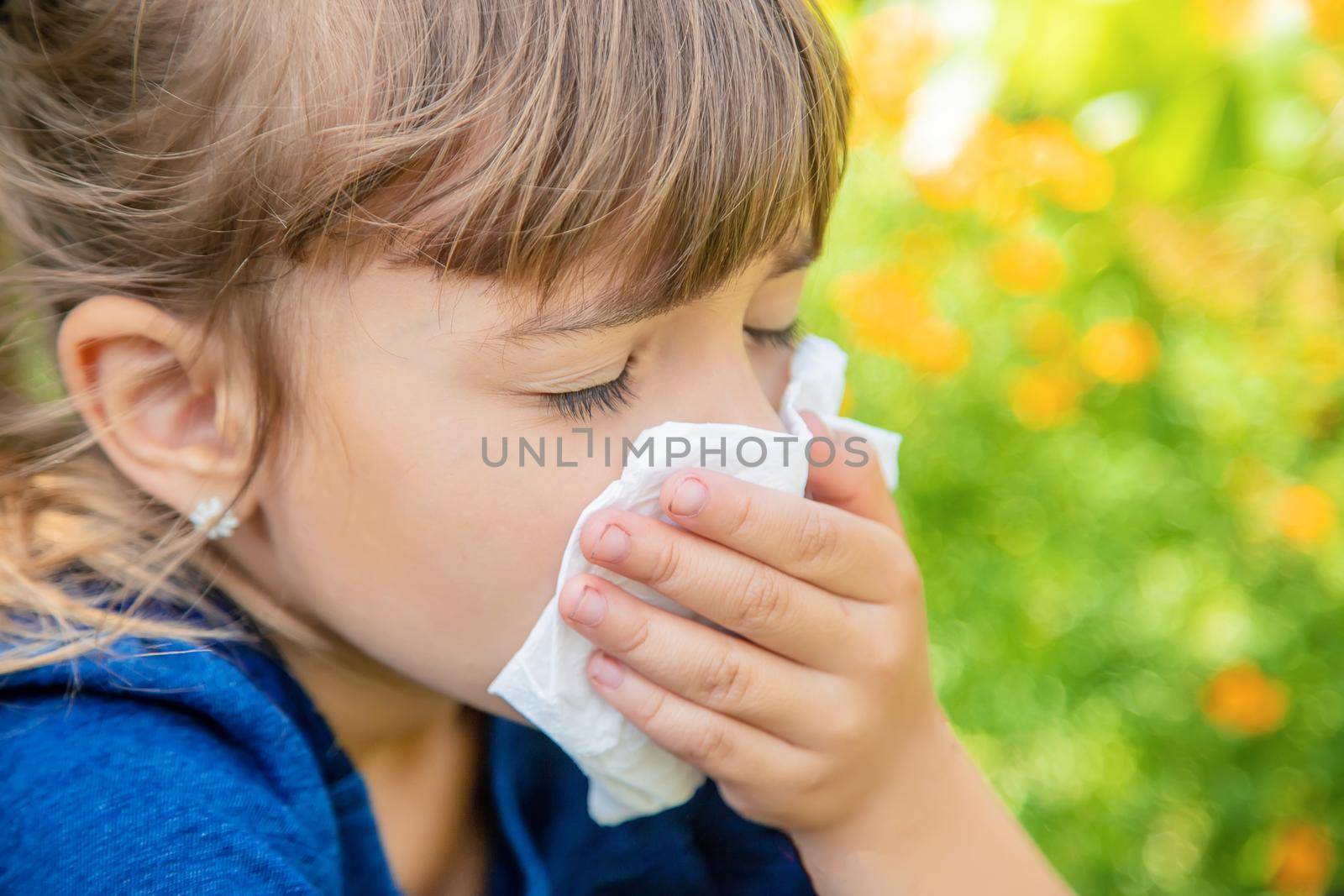 Seasonal allergy in a child. Coryza. Selective focus.