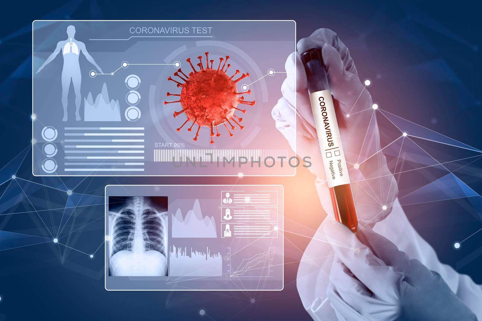 Coronavirus COVID-19 medical test vaccine research and development concept. Scientist in laboratory study and analyze scientific sample of Coronavirus antibody to produce drug treatment for COVID-19.