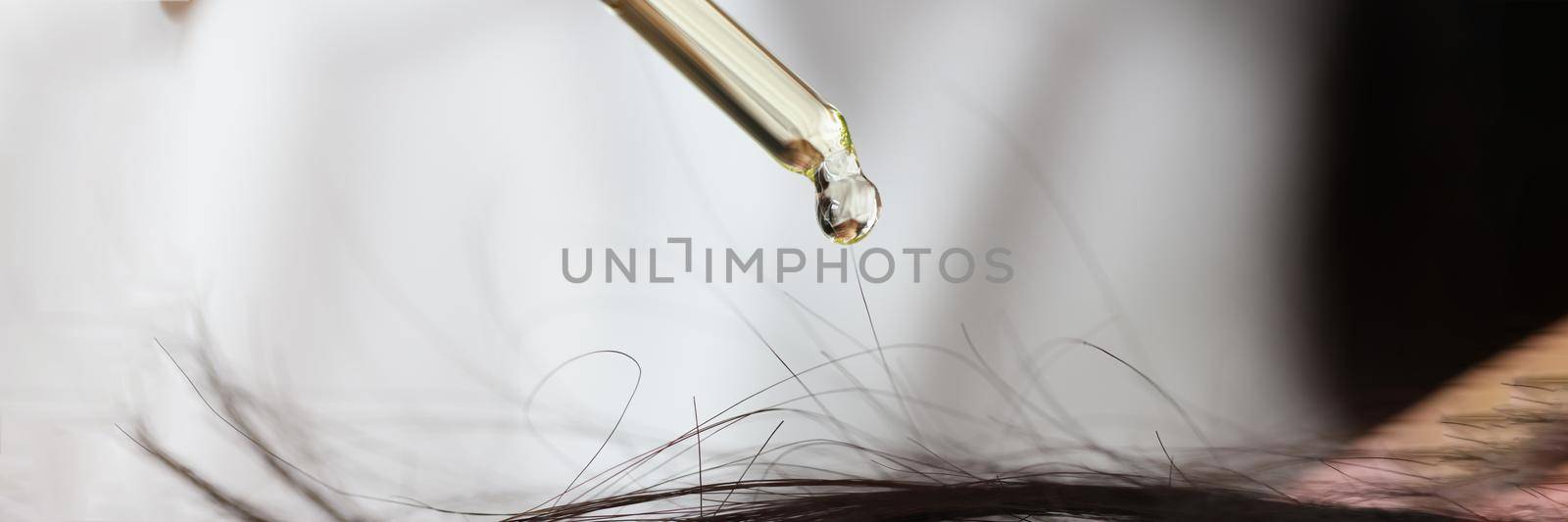 Oil from a pipette drips onto the hair on the head by kuprevich