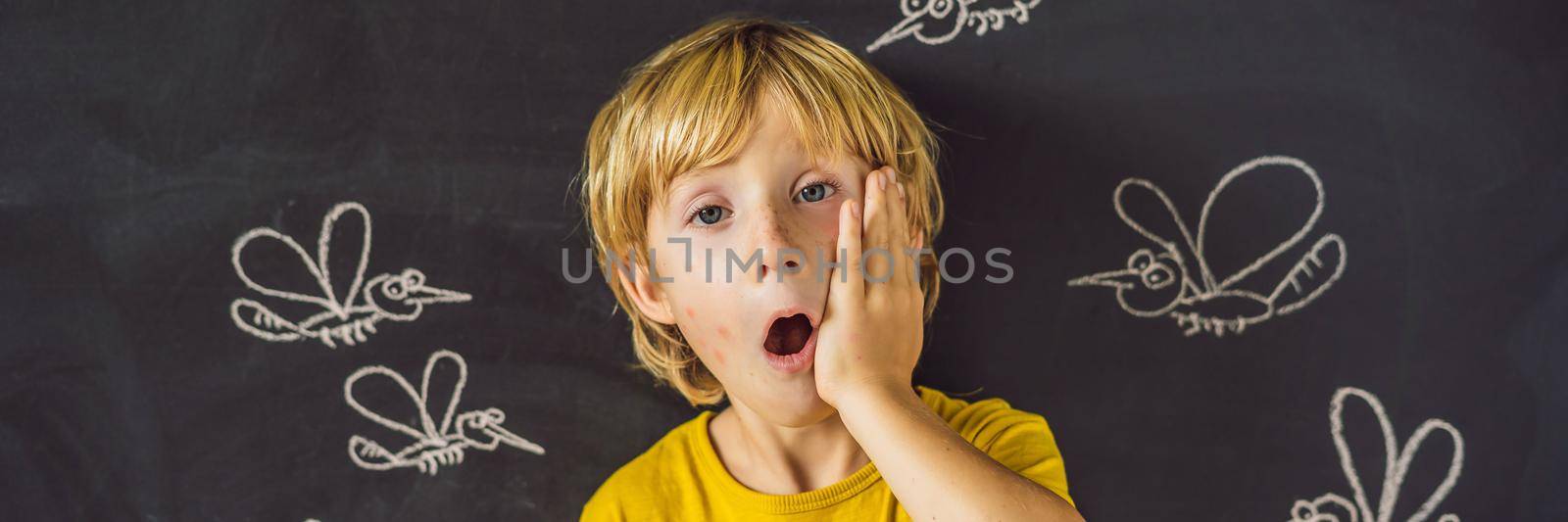 The boy is bitten by mosquitoes on a dark background. On the blackboard with chalk painted mosquitoes. BANNER, LONG FORMAT