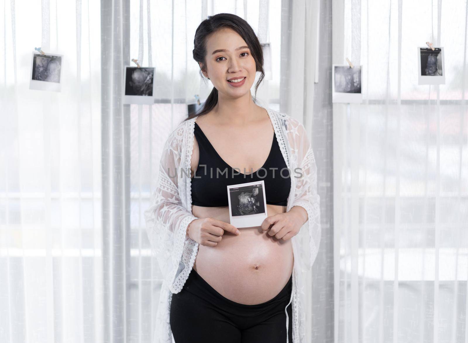 happy pregnant woman holding ultrasound scan photo