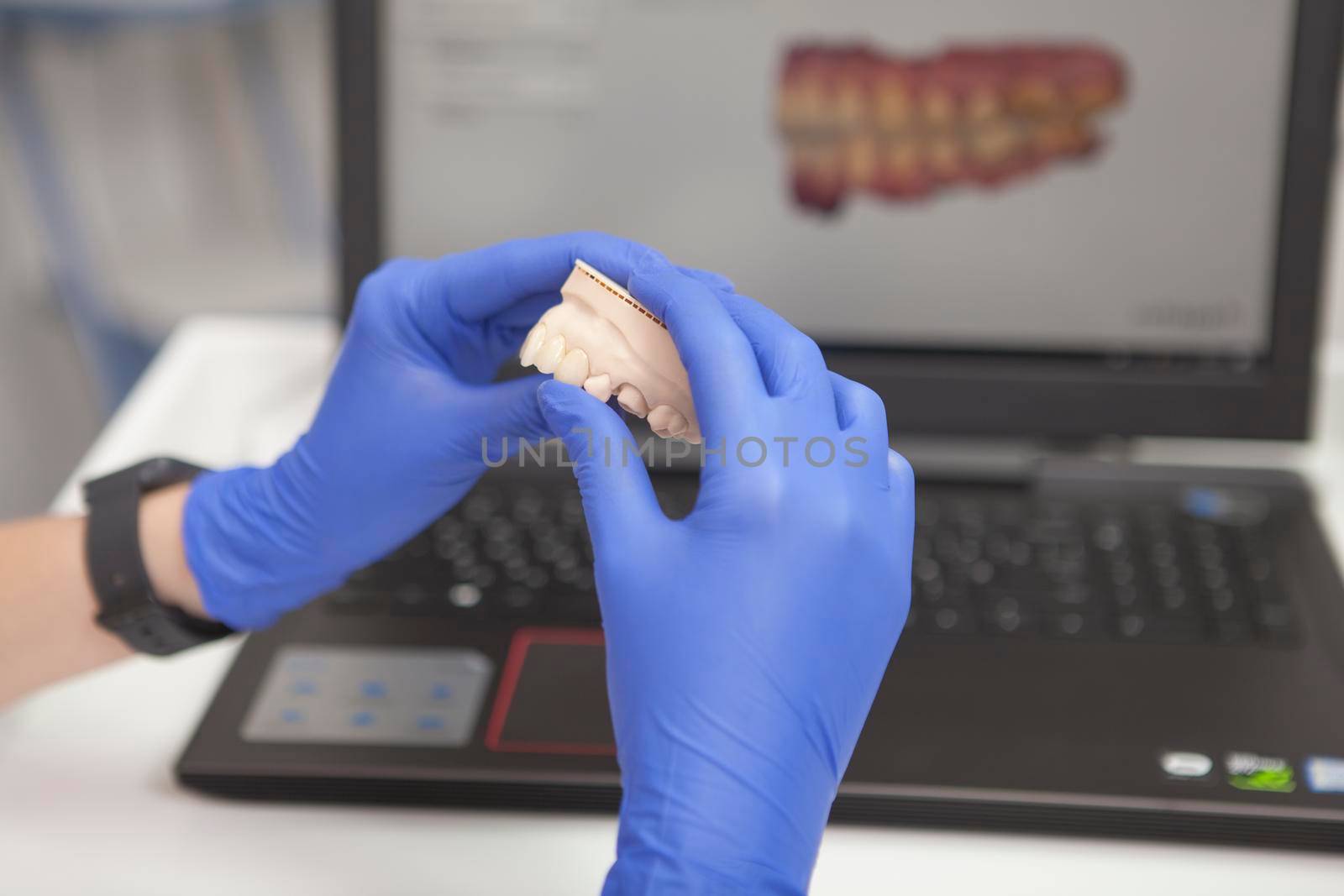 Cropped close up of unrecognizable dentist holding dental model