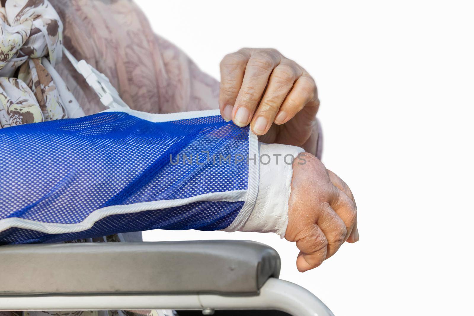 Senior woman with a broken arm on a plaster cast