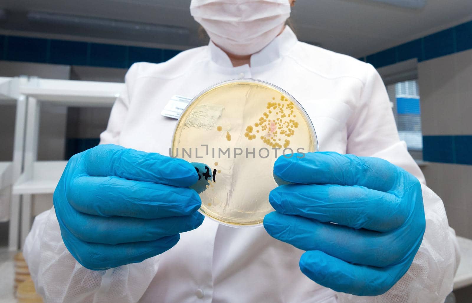 Hand Holds Petri Dish with Bacteria Culture