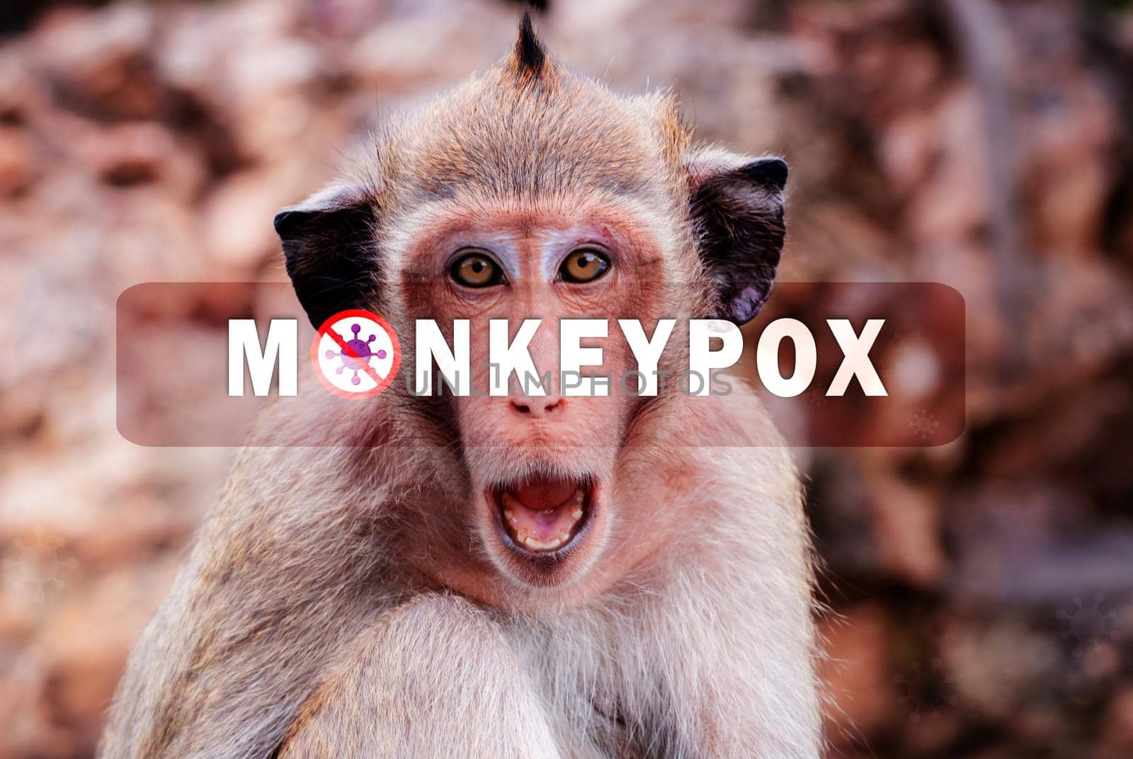 Monkeypox outbreak concept. Monkeypox is caused by monkeypox virus. Monkeypox is a viral zoonotic disease. Virus transmitted to humans from animals. Monkeys may harbor the virus and infect people.