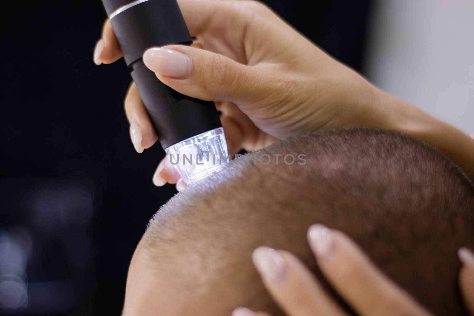 Trichoscope examination of hair, scalp and hair follicles of a young man. Copy space. The head of a man with thinning hair during the Trichology.