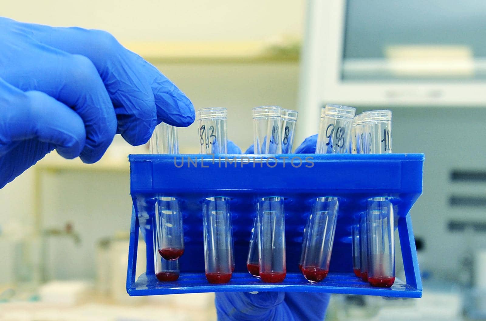 Medical or scientific researcher or doctor looking at a test tube with liquid red solution in a laboratory