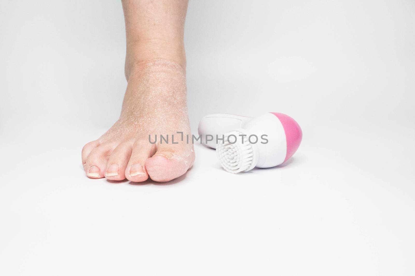 Beautiful barefoot female dry skin feet with a set of the pedicure tools by JuliaDorian