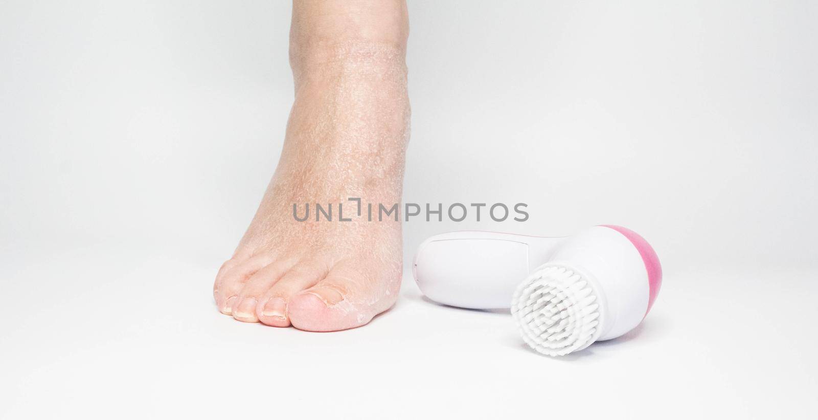 Beautiful barefoot female dry skin feet with a set of the pedicure tools on white