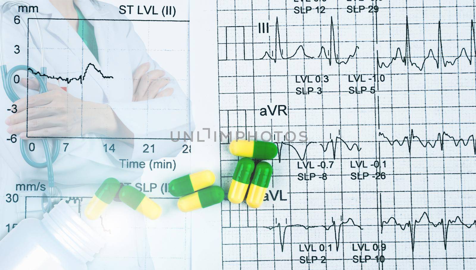 EKG or ECG graph report paper. EST result and green-yellow capsule pills with cardiologist specialist doctor wear white uniform. Physician stand with arms crossed and hand holding stethoscope.