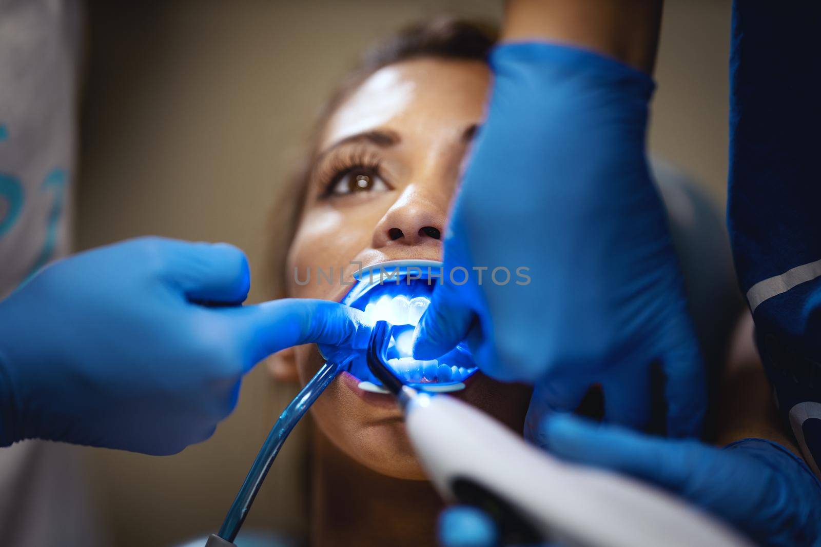 The beautiful young woman is at the dentist. She sits in the dentist's chair and the dentist sets braces on her teeth putting aesthetic self-aligning lingual locks with an infrared lamp.