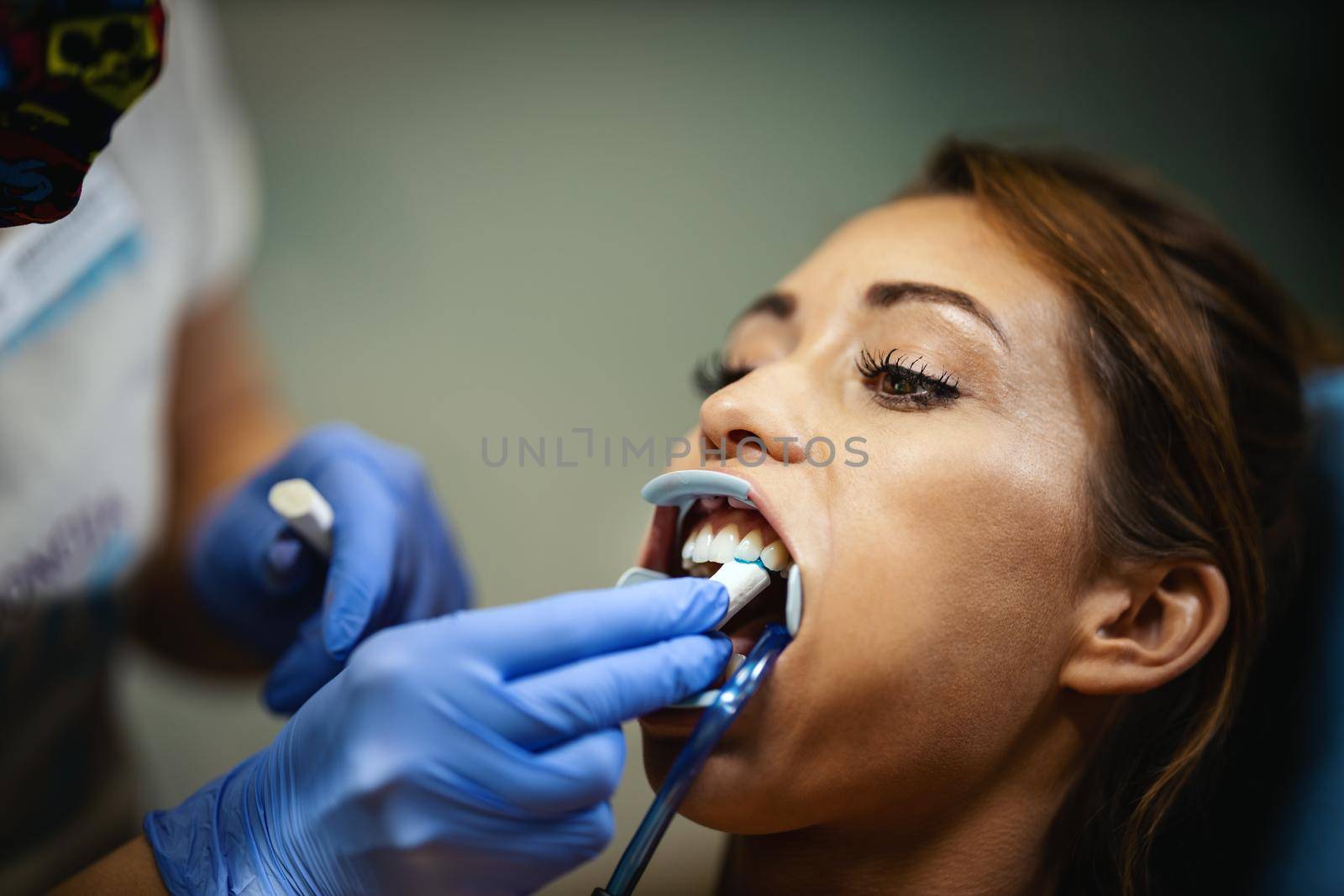 The beautiful young woman is at the dentist. She sits in the dentist's chair and the dentist sets braces on her teeth putting aesthetic self-aligning lingual locks.