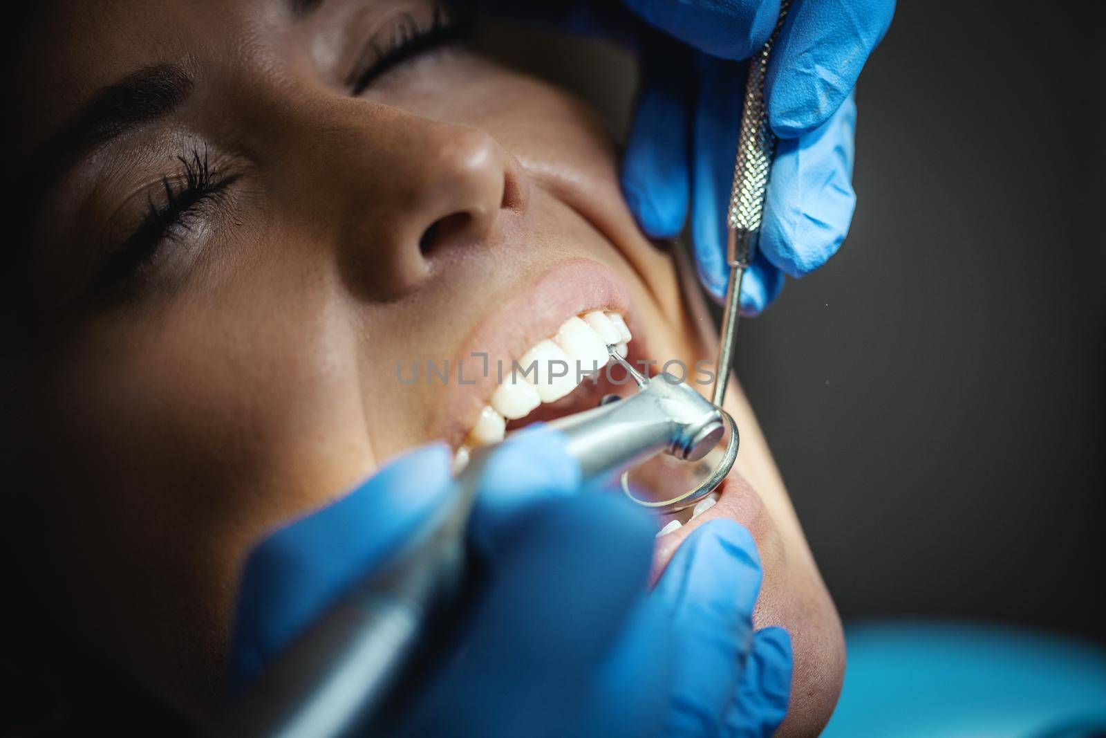 The beautiful young woman is at the dentist. She sits in the dentist's chair and the dentist repair her teeth. Close-up.