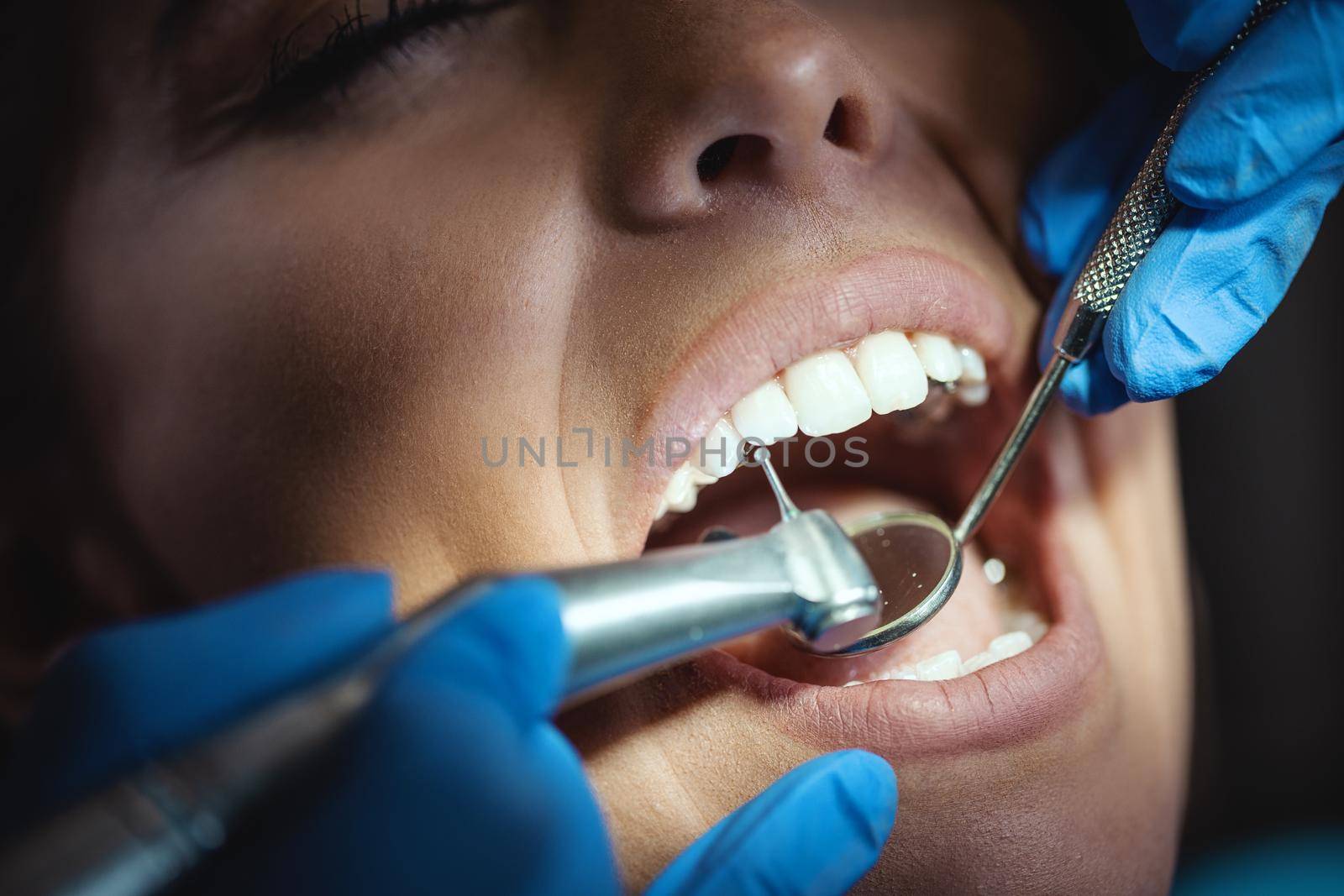 The beautiful young woman is at the dentist. She sits in the dentist's chair and the dentist repair her teeth. Close-up.