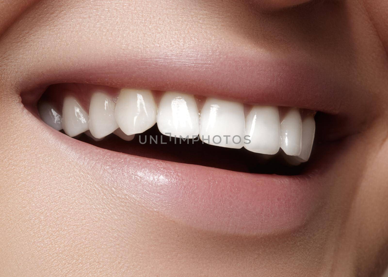 Beautiful smile with whitening teeth. Dental photo. Macro closeup of perfect female mouth, lipscare rutine.