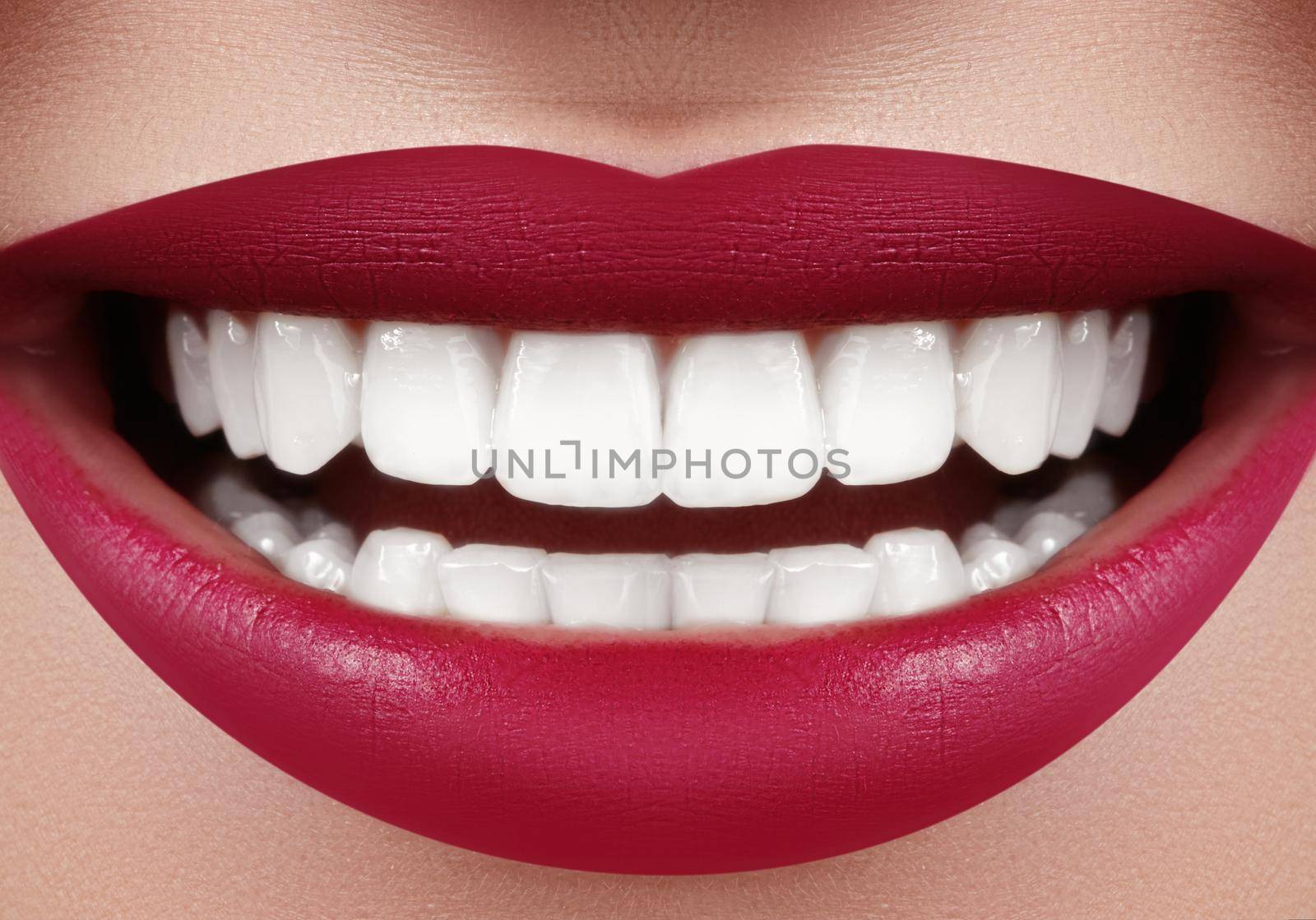 Beautiful Smile with Whitening Teeth. Dental Photo. Macro Closeup of Perfect Female Mouth, Lipscare Rutine. Care about Teeth, Ortodontic Treatment