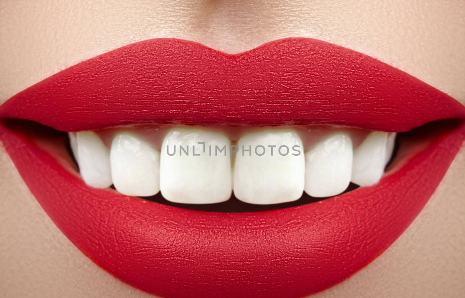Wide smile of young beautiful woman, perfect healthy white teeth. Dental whitening, ortodont, care tooth and wellness by MarinaFrost
