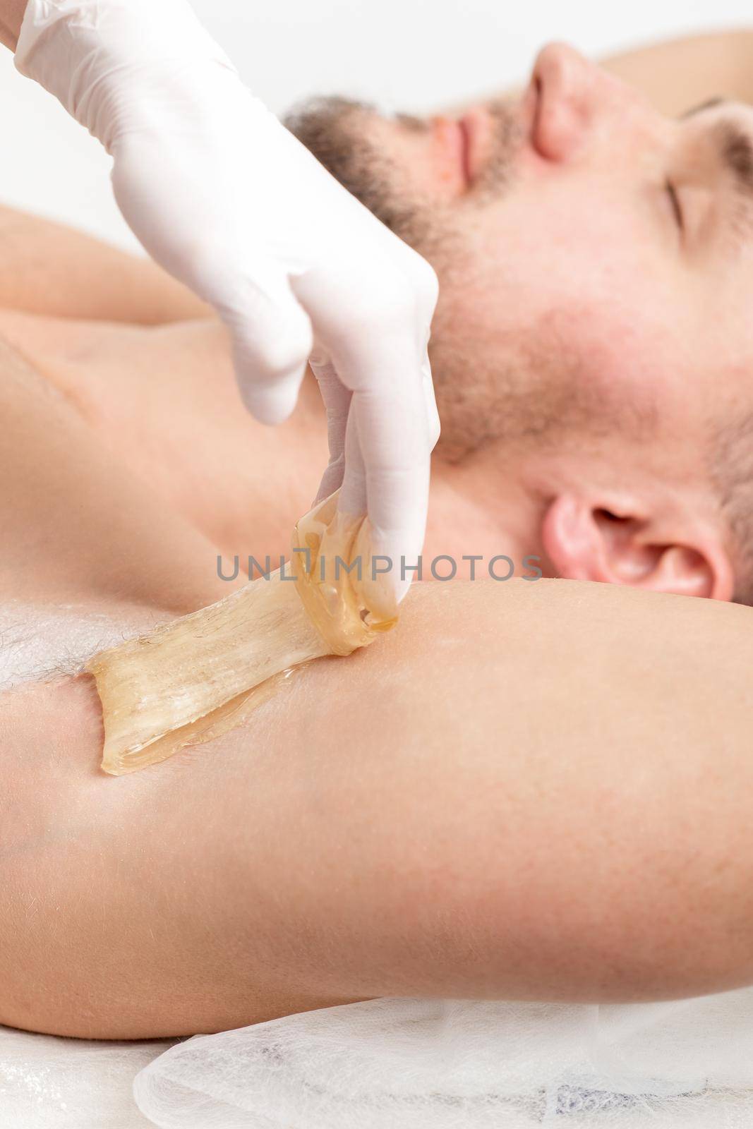 Depilation and epilation male armpit with liquid sugar paste. Hand of cosmetologist applying wax paste on armpit of man. Smooth underarm concept