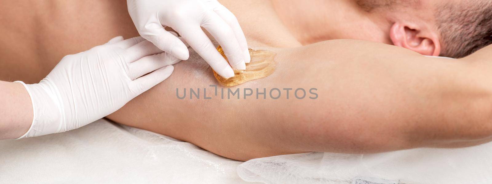 Depilation and epilation male armpit with liquid sugar paste. Hand of cosmetologist applying wax paste on armpit of man. Smooth underarm concept