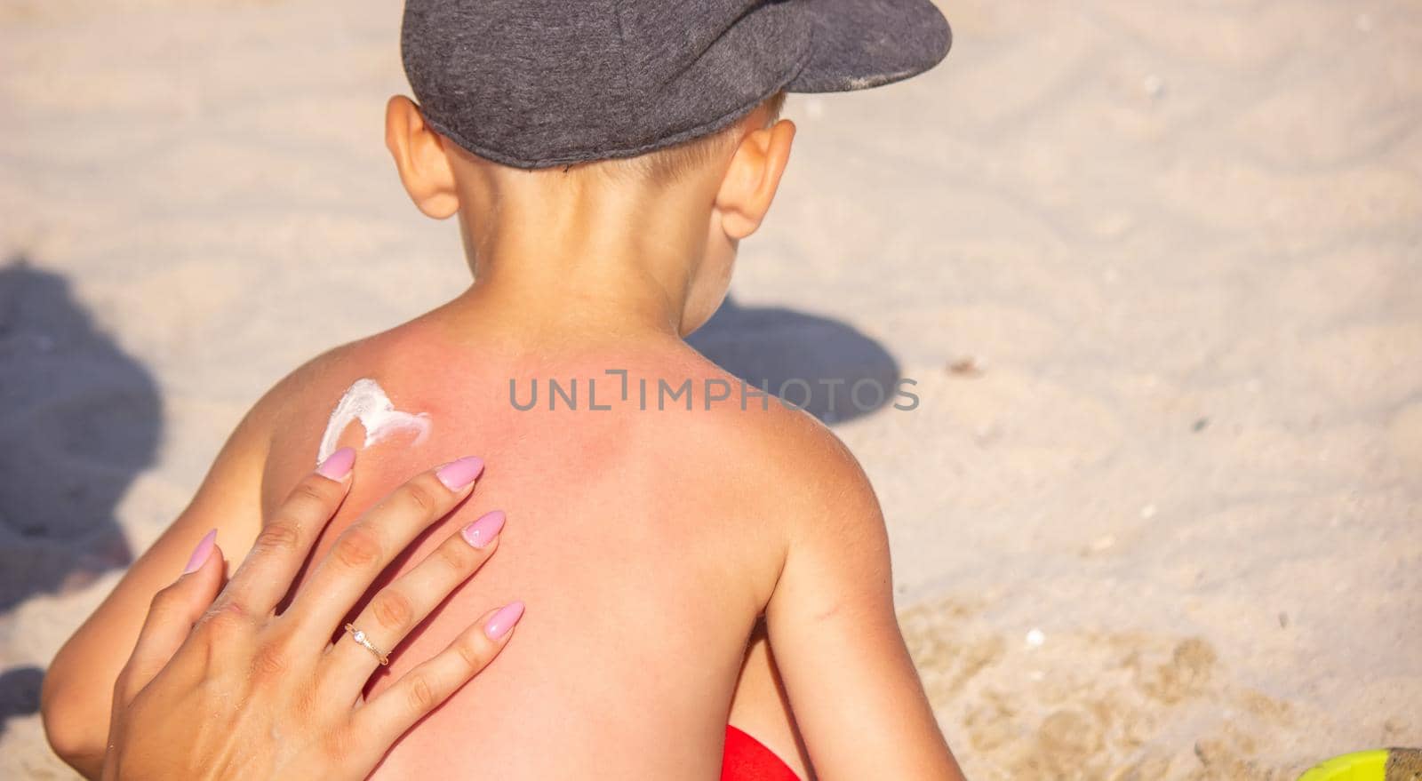 Mom puts sunscreen on Sin's back in the shape of a heart. selective focus