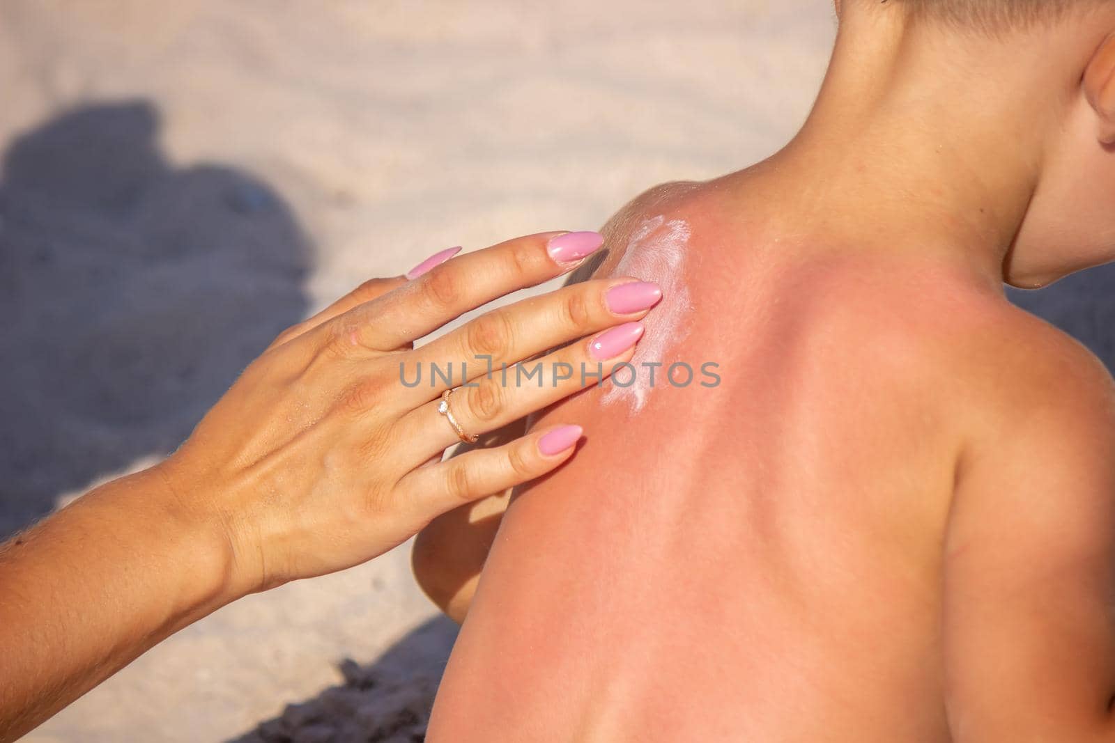 Mom puts sunscreen on Sin's back in the shape of a heart. selective focus