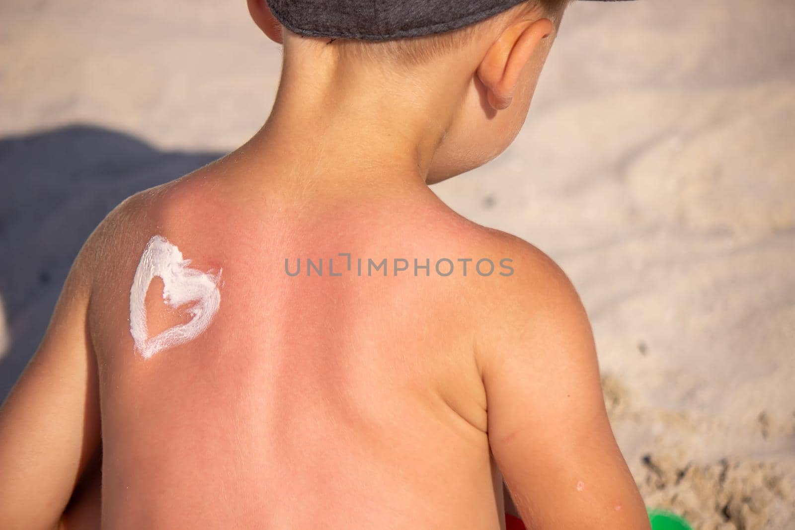 Mom puts sunscreen on Sin's back in the shape of a heart. selective focus