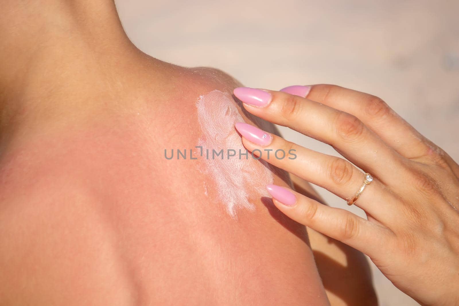 Mom puts sunscreen on Sin's back in the shape of a heart. selective focus