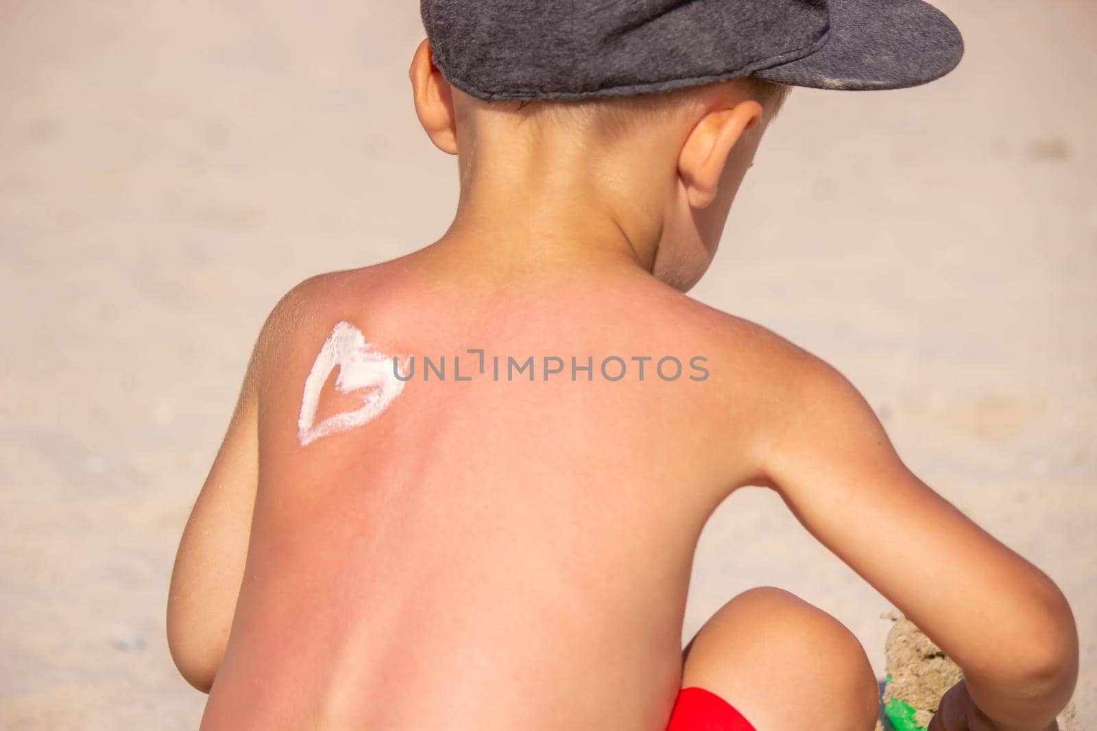 Mom puts sunscreen on Sin's back in the shape of a heart. selective focus