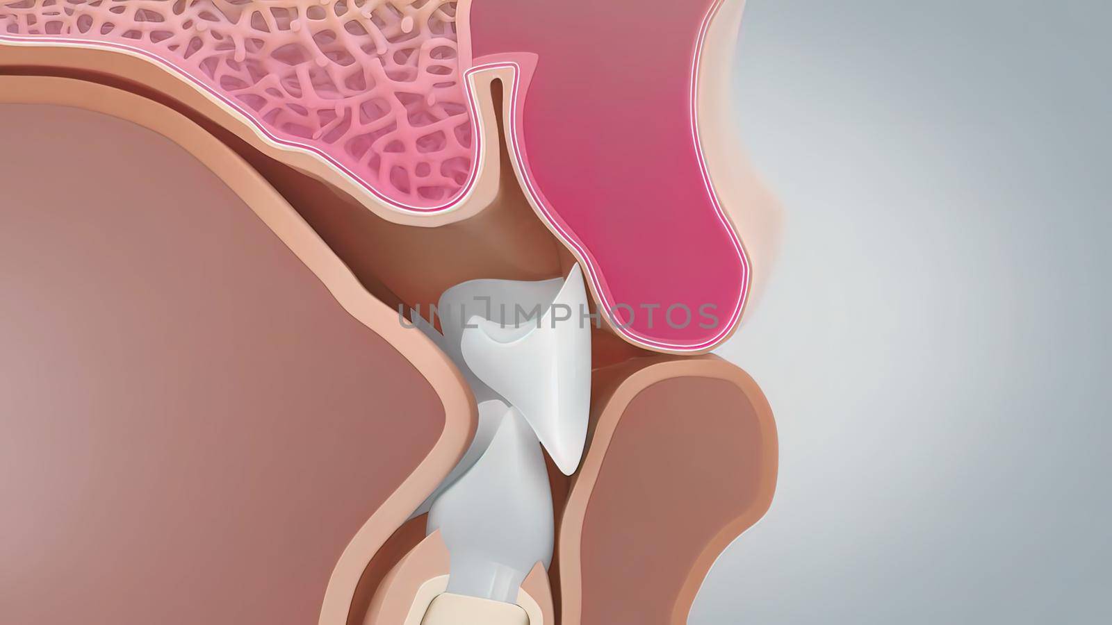 As the gum and connective tissues pull away from the tooth, a pocket forms between the tooth and gum, which begins to accumulate bacteria. 3D illustration