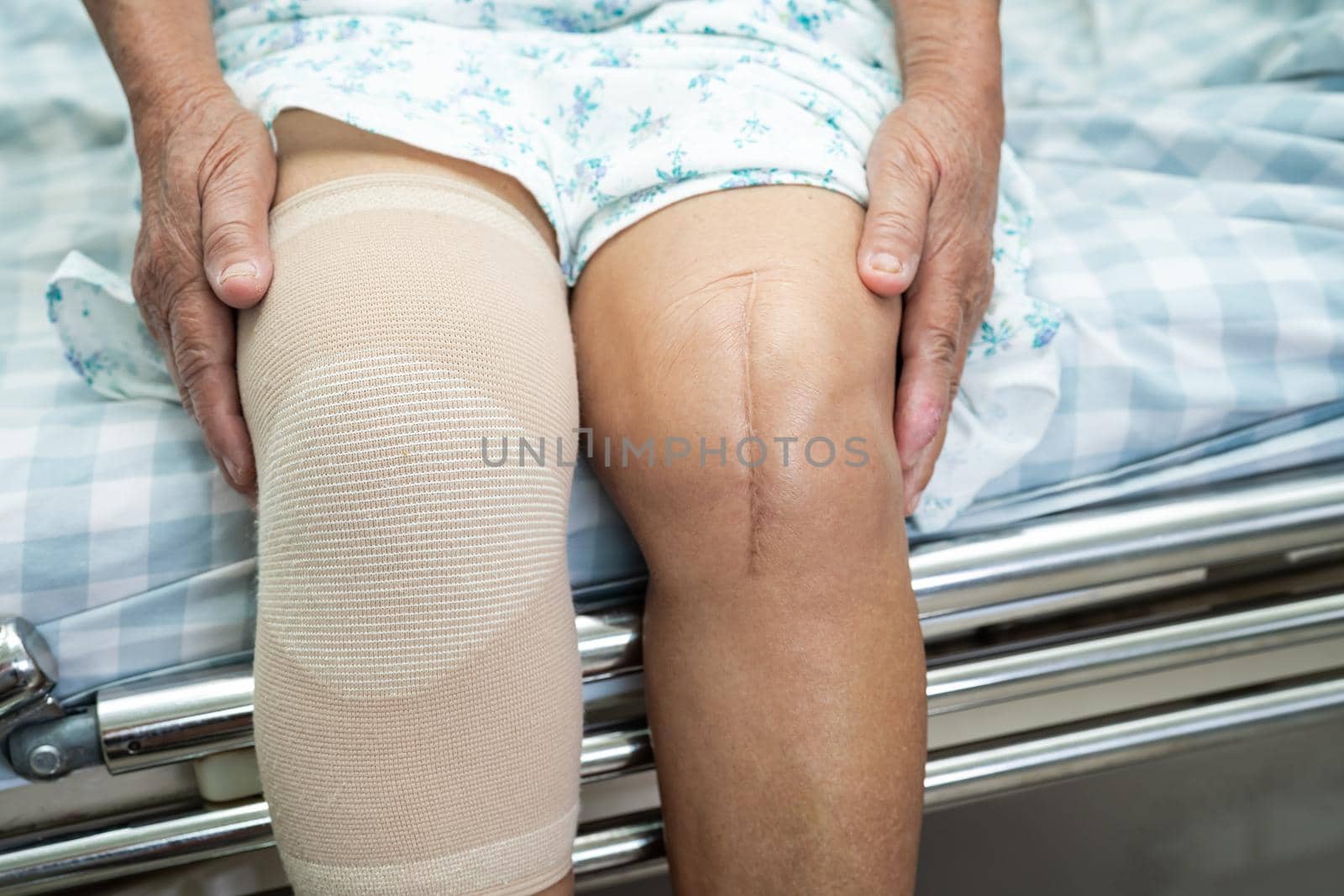 Asian senior or elderly old lady woman patient with knee support pain joint on bed in nursing hospital ward, healthy strong medical concept.