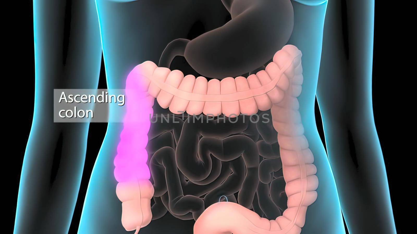 The large intestine is the final part of the gastrointestinal tract and digestive system in vertebrates. 3D illustration