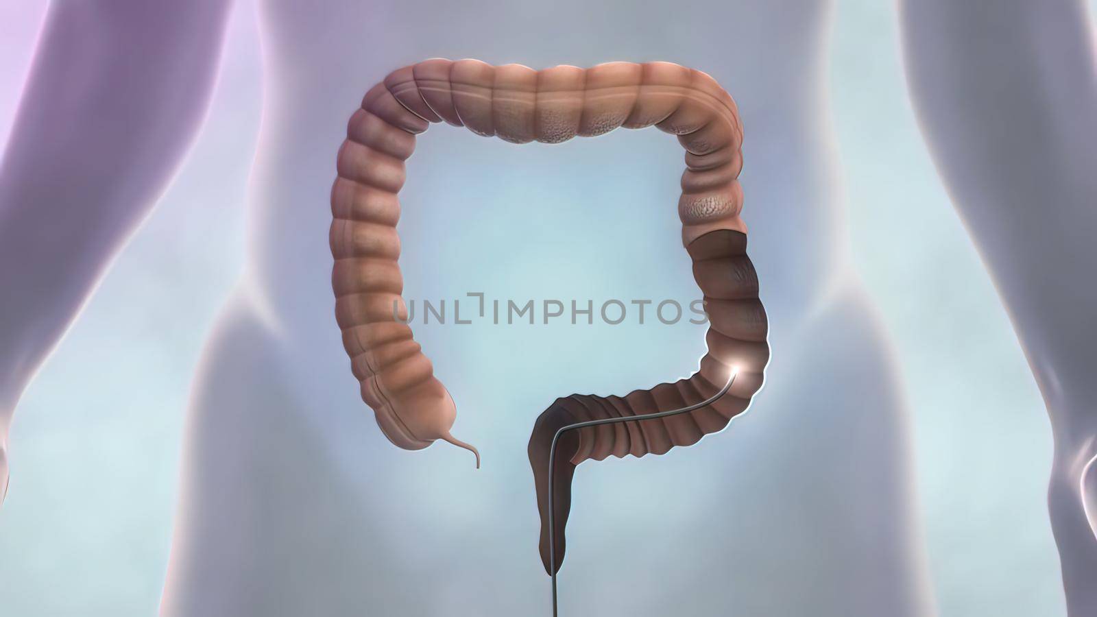 digestive system, colonoscopy 3D illustration
