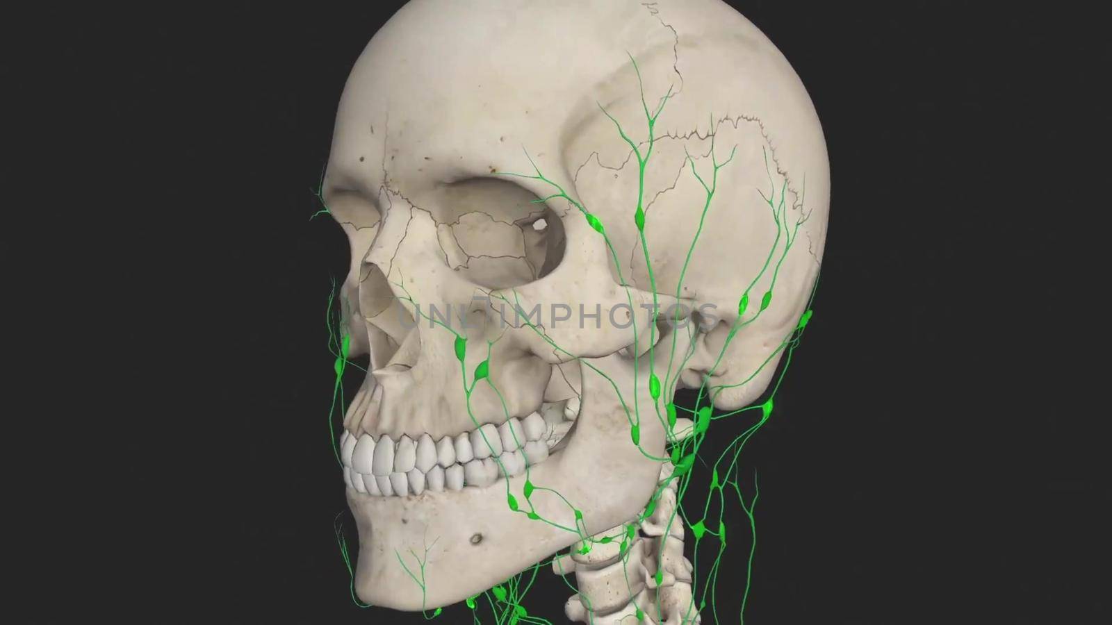 A thin tube that carries lymph (lymphatic fluid) and white blood cells through the lymphatic system. Also called lymphatic vessel.