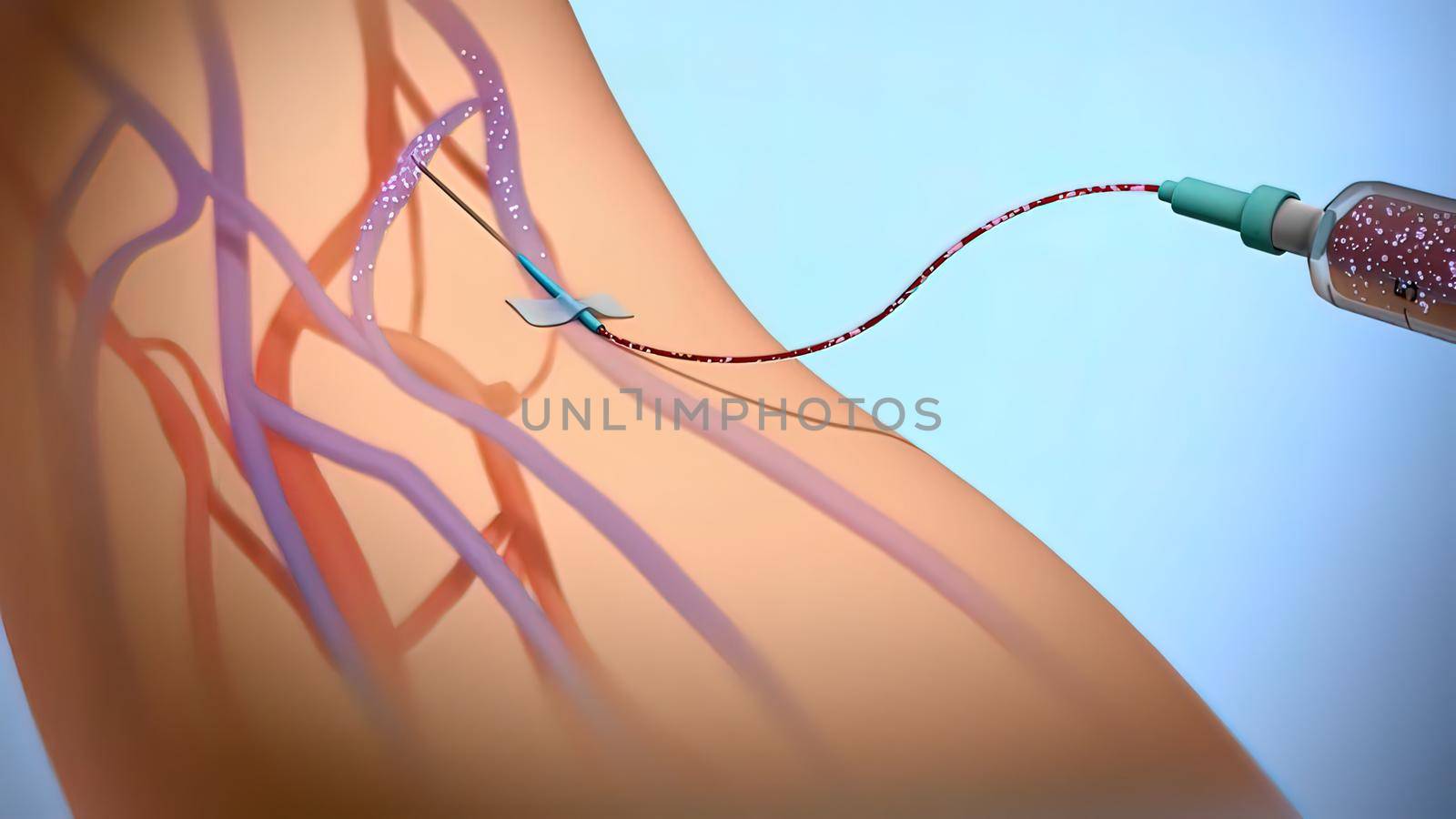 Serum At The Emergency Medicine 3D illustration