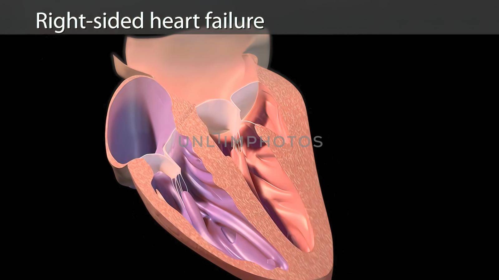 The right atrium receives blood from the veins and pumps it to the right ventricle. 3D illustration